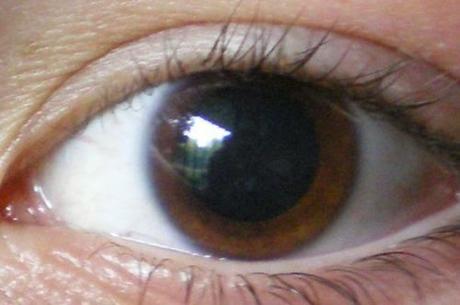 Lesiones en la cabeza: 8 Síntomas que no debes ignorar