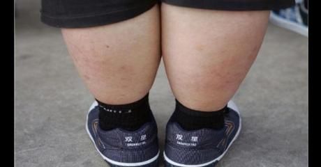 Si eres obeso de niño ¿Lo seguirás siendo siempre?