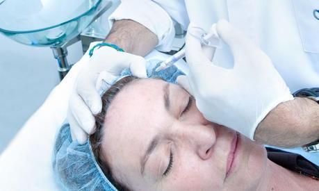 Mesolift o una auténtica inyección de vitaminas para la piel El mesolift es un tratamiento de mesoterapia de vitaminas.