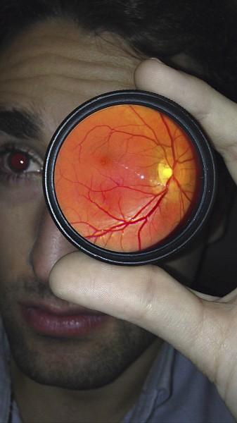 Autoexplorando el interior del ojo con el móvil Autoexploración retina