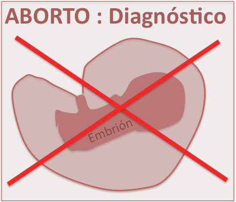ABORTO : ¿Qué es y cómo se hace el diagnostico ?