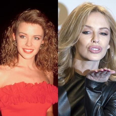 Kylie Minogue