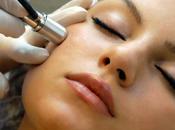 Peeling físico. Laserabrasión