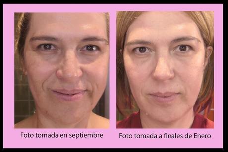 Probando, probando: La nueva gama Skin Solution de Bella Aurora