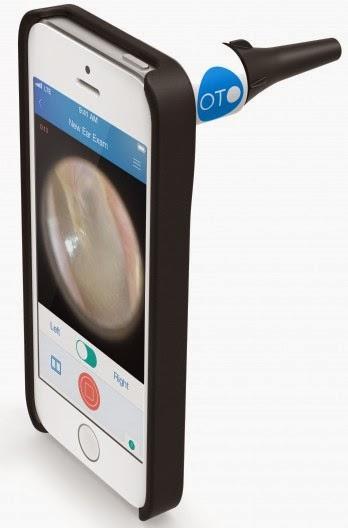 Diagnóstico de otitis en el niño con un teléfono movil (Cellscope)