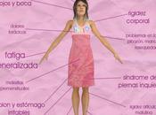 Síntomas Fibromialgia