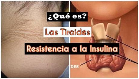 Tiroides y resistencia a la insulina