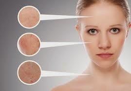 Qué horror... no me entra el vestido de novia!