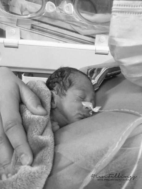 Historia de un nacimiento prematuro