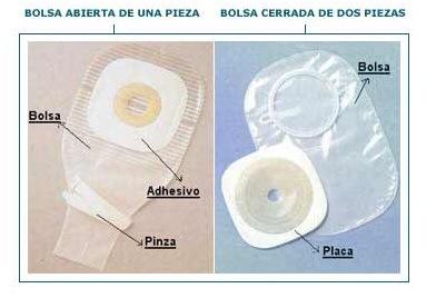 tipo-de-bolsas-de-ostomias