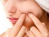 Tratamiento Natural para Acne: Factores puede Transformar Piel