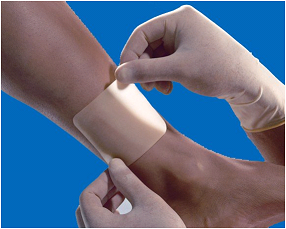 LAS ÚLCERAS CRÓNICAS