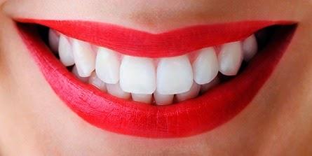 Trucos para blanquear los dientes