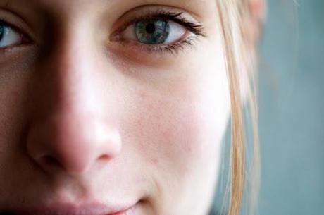 Trucos para eliminar los puntos negros