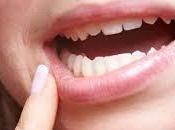 aftas bucales como curarlas