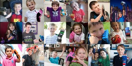 Una mano protésica de superhéroe