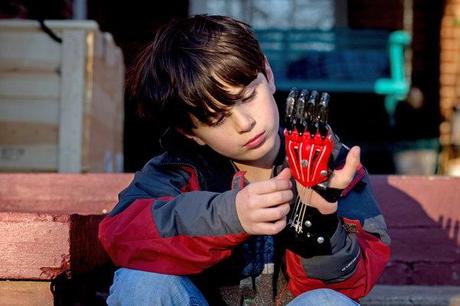 Una mano protésica de superhéroe