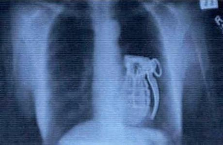 Curiosas y raras radiografías