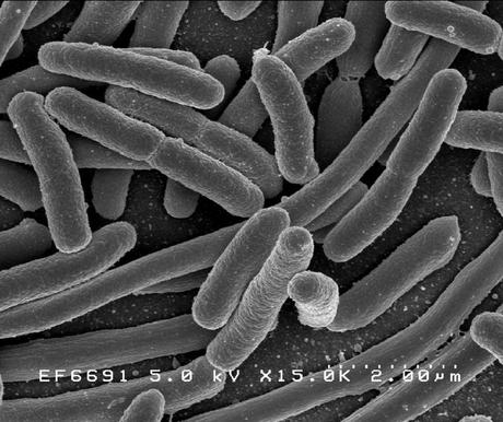 E. coli, miembro destacado de la microbiota.