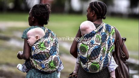 bebes-albinos-tanzania