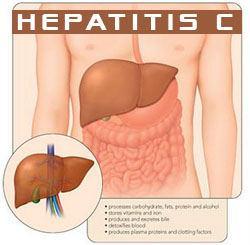 Hepatitis c sovaldi gilead