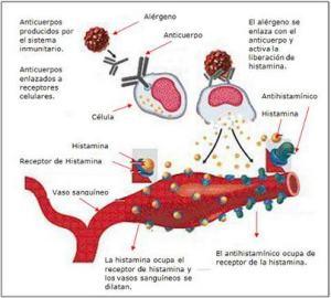Escombroidosis