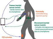Cinturón sensores estimuladores para tratar Parkinson