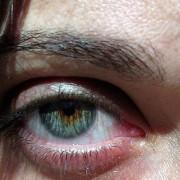 Di adiós a las ojeras