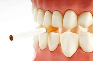 Implante Dental Malaga