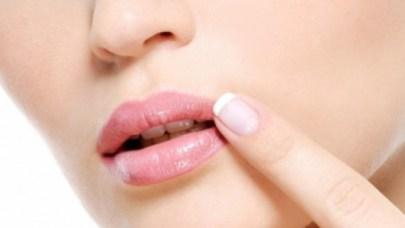 herpes-labial-saude-boa-forma-12327-1-570x321