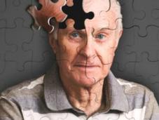 prueba piel podría detectar tempranamente Alzheimer