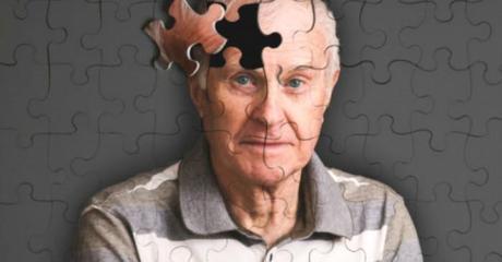 Una prueba de la piel podría detectar tempranamente el Alzheimer