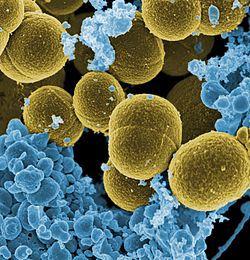 Staphylococcus aureus, una de las bacterias que ofrecen mayor resistencia a los antibióticos