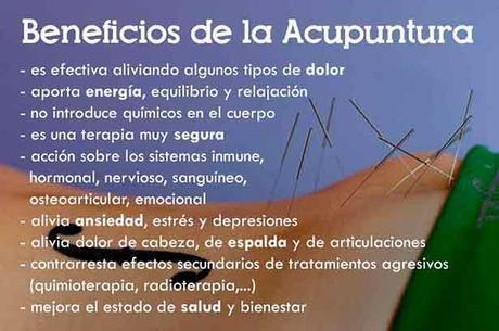 Beneficios-Acupuntura