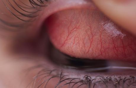 Macrofotografía del ojo humano conjuntiva-tarsal