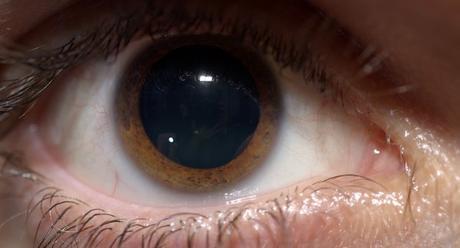 Macrofotografía del ojo humano dilatado-con-ciclo