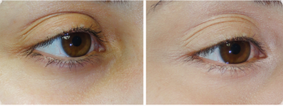 TRUCOS PARA CAMUFLAR LAS IMPERFECCIONES TRUCOS PARA CAMUFLAR LAS IMPERFECCIONES