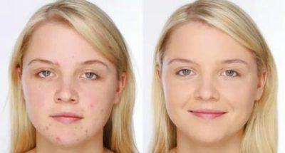 TRUCOS PARA CAMUFLAR LAS IMPERFECCIONES TRUCOS PARA CAMUFLAR LAS IMPERFECCIONES