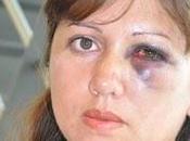 mujer golpeada reclama liberen agresor: sale, mata"
