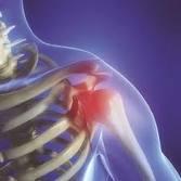 Causas del dolor de hombro