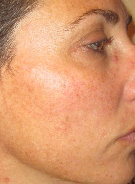 mascarilla, hi model face, belleza,