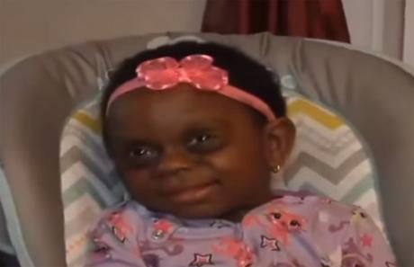 Síndrome de Duplicación del Cromosoma