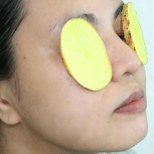 REMEDIOS PARA LAS OJERAS CUBRIR OJERAS