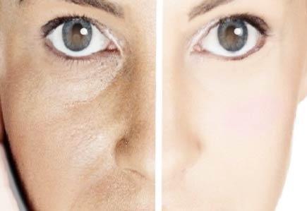 cosmética natural poros dilatados