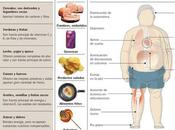 Obesidad infantil, riesgos