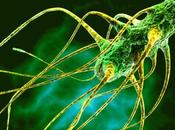 Samonelosis, toxiinfección alimentaria.