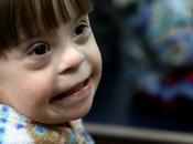 solicita cambiar definiciones subnormal, mongolismo síndrome Down