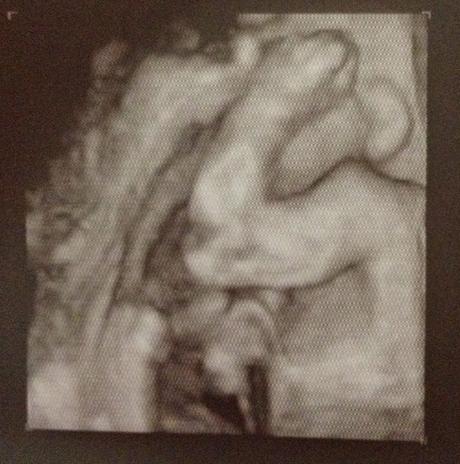 30 semanas y Ecografía 4D / 30 weeks and 4D Ultrasound
