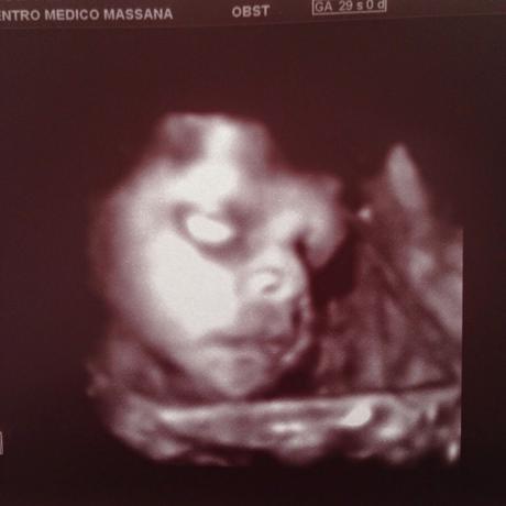 30 semanas y Ecografía 4D / 30 weeks and 4D Ultrasound