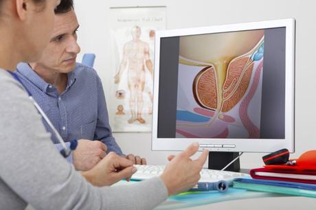 riesgo de dutasterida de cáncer de próstata
